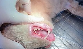 麻醉洗牙 vs 免麻醉洗牙